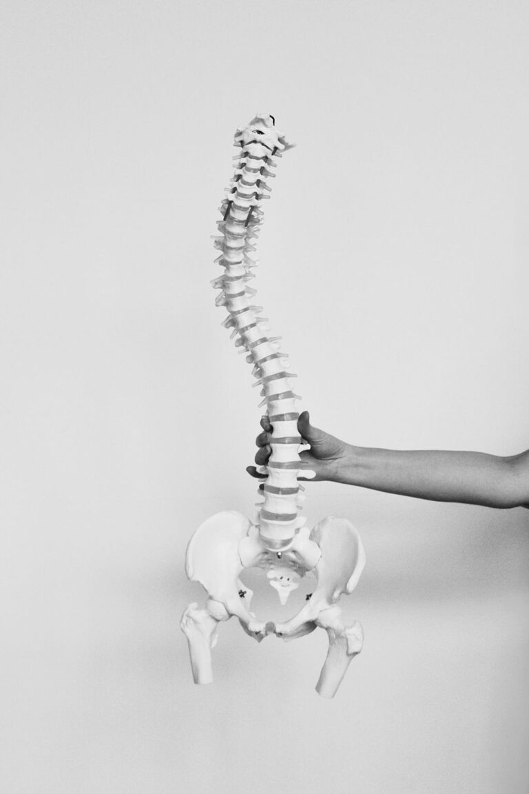 picture of scoliotic skeleton spine