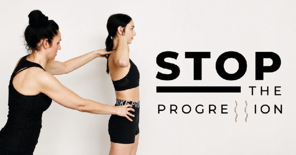 STOP THE PROGRESSION Logo with Schroth PT MELINDA demonstrating Schroth scoliosis treatment on a patient